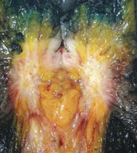 Description of the image